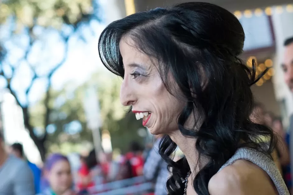 Doenças que parecem saídas de um filme de terror